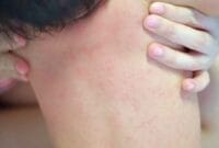 apa itu ruam pada bayi, apa obat ruam pada bayi, apakah ruam pada bayi bisa hilang, atasi ruam pada bayi, bedak untuk ruam pada bayi, berapa lama ruam pada bayi hilang, cara hilangkan ruam pada bayi, cara mengatasi ruam pada bayi, cara mengatasi ruam pada bayi akibat popok, cara menghilangkan ruam pada bayi, cara nak hilangkan ruam pada bayi, cara nak menghilangkan ruam pada bayi, cara obati ruam pada bayi, ciri ruam pada bayi, ciri2 ruam pada bayi, contoh ruam pada bayi, cream ruam pada bayi, cream ruam pada leher bayi, cream untuk ruam pada bayi, elak ruam pada bayi, foto ruam popok pada bayi, gambar ruam campak pada bayi, gambar ruam pada bayi, gambar ruam popok pada bayi, gambar ruam popok pada bayi laki laki, gambar ruam popok pada bayi perempuan, jenis ruam pada bayi, jenis ruam popok pada bayi, jurnal ruam popok pada bayi, kapan ruam susu pada bayi hilang, krim untuk mengatasi ruam pada bayi, makanan yang menyebabkan ruam pada bayi, mengatasi gatal ruam pada bayi, mengatasi ruam pada bayi akibat pampers, mengatasi ruam pada bayi baru lahir, mengatasi ruam pada selangkangan bayi, mengatasi ruam pada wajah bayi, mengobati ruam pada bayi secara alami, obat alami untuk ruam pada bayi, obat buat ruam pada bayi, obat gatal ruam pada bayi, obat herbal ruam pada bayi, obat ruam jamur pada bayi, obat ruam pada bayi, obat ruam pada bayi alami, obat ruam pada bayi baru lahir, obat ruam pada bayi di leher, obat ruam pada muka bayi, obat ruam popok pada bayi yang ampuh, obat untuk ruam pada bayi, penyebab ruam pada wajah bayi, petua hilangkan ruam pada bayi, ruam alergi pada bayi, ruam asi pada bayi, ruam campak pada bayi, ruam di bibir bayi, ruam di hidung bayi, ruam di jidat bayi, ruam di kepala bayi selepas cukur, ruam di lengan bayi, ruam di lidah bayi, ruam di lutut bayi, ruam di muka bayi baru lahir, ruam di muka bayi selepas demam, ruam di paha bayi, ruam di perut bayi, ruam di pipi bayi karena asi, ruam di telinga bayi, ruam di tengkuk bayi, ruam di tubuh bayi, ruam di wajah bayi baru lahir, ruam di wajah bayi karena asi, ruam di wajah bayi setelah demam, ruam eksim pada bayi, ruam gatal pada bayi, ruam herpes pada bayi, ruam hiv pada bayi, ruam jamur pada bayi, ruam jerawat pada bayi, ruam merah dan gatal pada bayi, ruam merah gatal pada bayi, ruam merah pada bayi 7 bulan, ruam merah pada bayi 8 bulan, ruam merah pada bayi hilang timbul, ruam merah pada bayi setelah panas, ruam merah pada bayi tanpa demam, ruam merah pada muka bayi, ruam merah pada wajah bayi, ruam nanah pada bayi, ruam pada badan bayi, ruam pada bayi, ruam pada bayi 1 bulan, ruam pada bayi 1 tahun, ruam pada bayi 2 bulan, ruam pada bayi 4 bulan, ruam pada bayi 6 bulan, ruam pada bayi 7 bulan, ruam pada bayi 8 bulan, ruam pada bayi akibat asi, ruam pada bayi baru lahir, ruam pada bayi covid, ruam pada bayi dan anak, ruam pada bayi dbd, ruam pada bayi demam, ruam pada bayi di leher, ruam pada bayi disebabkan, ruam pada bayi karena alergi, ruam pada bayi karena covid, ruam pada bayi karena pampers, ruam pada bayi karena popok, ruam pada bayi kenapa, ruam pada bayi kulit, ruam pada bayi setelah demam, ruam pada bayi setelah imunisasi, ruam pada bayi setelah panas, ruam pada bayi tak kunjung sembuh, ruam pada bokong bayi, ruam pada buah zakar bayi, ruam pada dada bayi, ruam pada dagu bayi, ruam pada dahi bayi, ruam pada daun telinga bayi, ruam pada dubur bayi, ruam pada kaki bayi, ruam pada kepala bayi, ruam pada kulit bayi baru lahir, ruam pada kulit bayi setelah demam, ruam pada leher bayi, ruam pada leher bayi baru lahir, ruam pada leher bayi berbau, ruam pada lengan bayi, ruam pada lidah bayi, ruam pada mata bayi, ruam pada miss v bayi, ruam pada muka bayi, ruam pada muka bayi 1 bulan, ruam pada muka bayi baru lahir, ruam pada mulut bayi, ruam pada paha bayi, ruam pada pipi bayi, ruam pada pipi bayi 6 bulan, ruam pada pipi bayi baru lahir, ruam pada popok bayi, ruam pada punggung bayi, ruam pada selangkangan bayi, ruam pada siku bayi, ruam pada tangan bayi, ruam pada telinga bayi, ruam pada tubuh bayi, ruam pada wajah bayi, ruam pada wajah bayi baru lahir, ruam pada wajah bayi karena asi, ruam popok pada bayi baru lahir, ruam popok pada bayi dan cara mengatasinya, ruam popok pada bayi obatnya apa, ruam popok pada bayi perempuan, ruam popok pada bayi tak kunjung sembuh, ruam ruam merah pada bayi, ruam ruam pada bayi, ruam ruam pada kulit bayi, ruam seperti jerawat pada bayi, ruam susu formula pada bayi, ruam susu pada bayi baru lahir, ruam susu pada muka bayi, ruam susu pada wajah bayi, ruam virus pada bayi, ruam yang berbahaya pada bayi, salep untuk ruam pada bayi, timbul ruam pada bayi setelah demam,